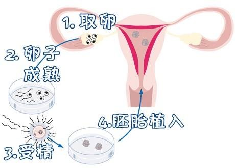 一般不妊検査・タイミング療法